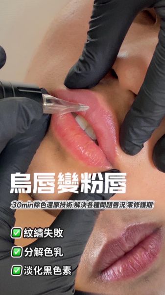 圖片 𝐀𝐦𝐚𝐫𝐚 𝐋𝐢𝐩𝐬除色還原術