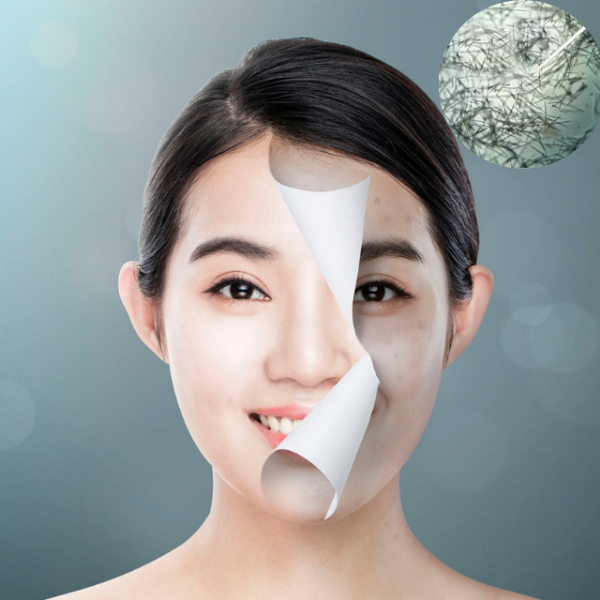 圖片 零毛孔救星/黑鑽矽晶煥膚100min/6堂