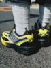 MM6 Maison Margiela x Salomon ACS Pro Black Blazing Yellow