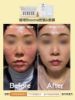 圖片 『抗老淡斑』Bioyona海洋胚顏修護安瓶 保濕 抗皺 抗老精華 美白淡斑 美白精華 修護精華 外泌體 精華液 保養品